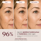 Seoul Calcium Dark Spot Eye Cream