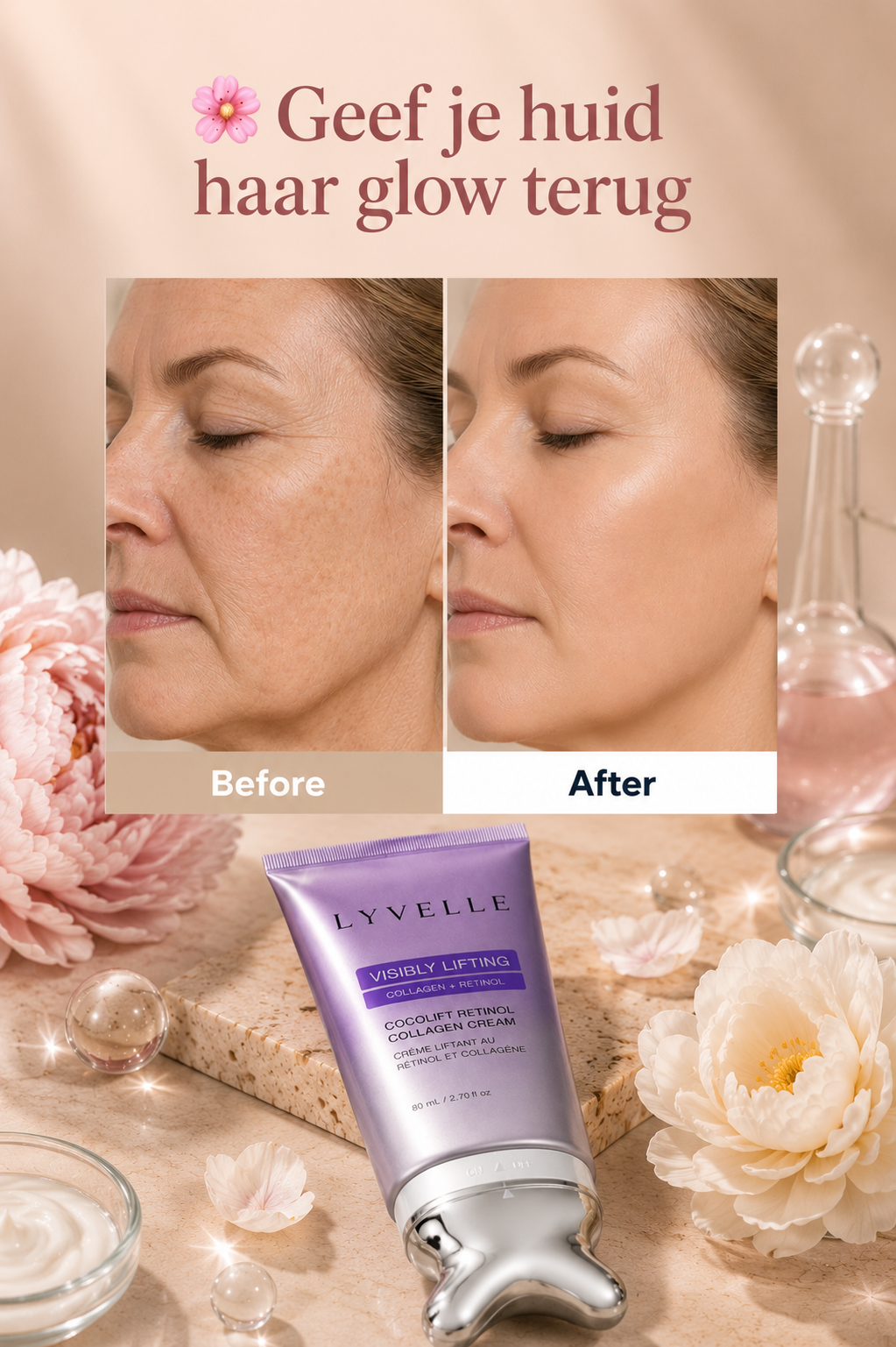 Lyvelle™ SkinLift